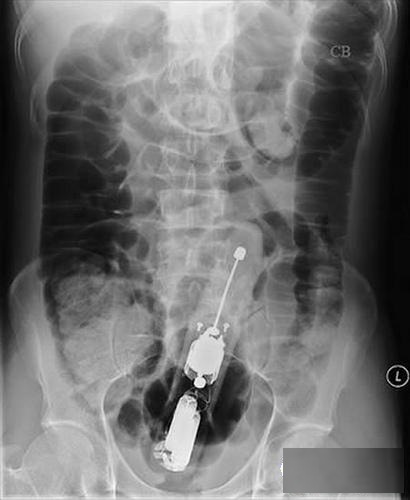 西西人体大胆瓣开下部自慰:07-16-26-35-36-41T：05,色情内容是不合法的，违反我国相关的法律法规。我们应该遵守法律和道德准则，远离色情内容。如果您有其他有益身心的娱乐需求，可以寻找一些正规的平台或文化活动，例如观看电影、参加体育运动、学习知识等，以丰富您的生活。