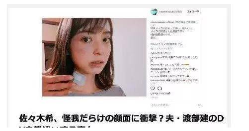 久久人妻AV无码中文专区:03-18-19-31-44-49R：35,久久人妻AV无码中文专区深度探索，内容与影响分析