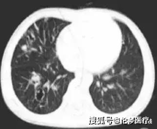 国产无遮挡吃胸膜奶免费看:01-06-07-09-16-29A：43,国产无遮挡吃胸膜奶资源的探索与赏析——01至29A的细致观察与体验分享