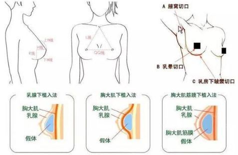 国产无遮挡吃胸膜奶免费看:02-08-31-36-40-47A：17,国产无遮挡吃胸膜奶的文化现象深度解析